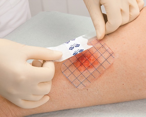 Yara Bakımının Önemi