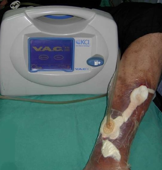 YARALARINIZ GÜVENDE